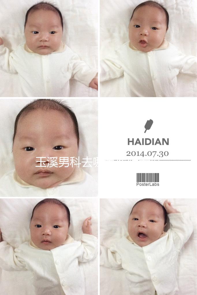 玉溪男科去哪家醫(yī)院看好，怎么選攻略，這個(gè)排行榜不要錯(cuò)過