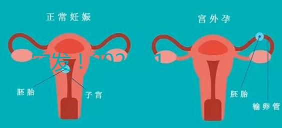 突發(fā)!2024.11.15,天津試管嬰兒納入醫(yī)保報(bào)銷(xiāo)(附14家醫(yī)保定點(diǎn)醫(yī)院)