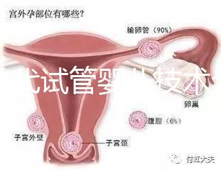 第一代試管嬰兒技術全解析:流程、適應癥及優缺點指南
