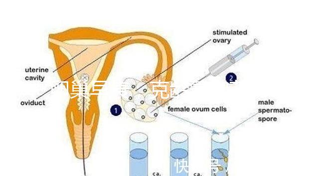 卵巢早衰，克齡蒙和芬嗎通藥物選擇引爭議