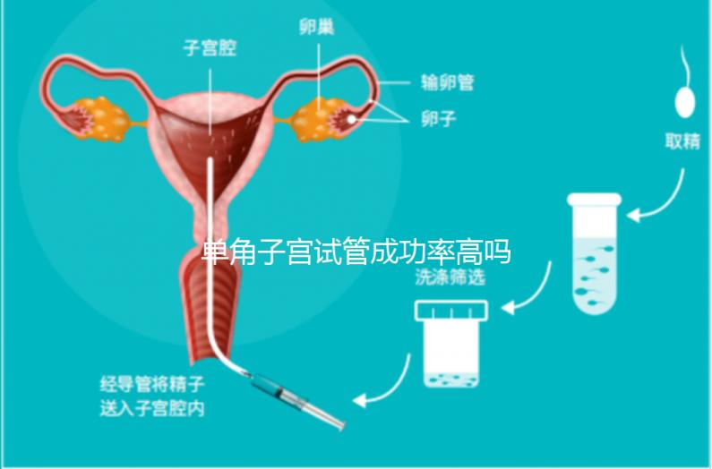 單角子宮試管成功率高嗎？送你5招降低胚胎著床的難度