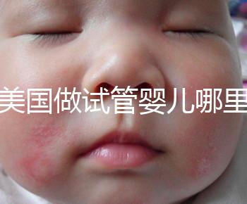 去美國做試管嬰兒哪里最好,4家好評(píng)輔助生殖機(jī)構(gòu)推薦