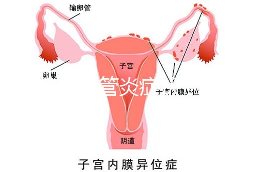 反流性食管炎癥狀（反流性食管炎癥狀有哪些反應）