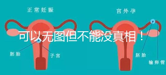 可以無圖但不能沒真相！段濤大夫帶你了解B超檢查報(bào)告單