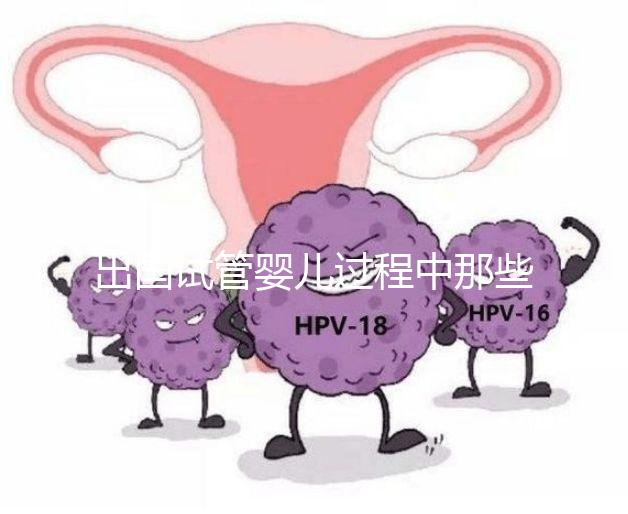 出國試管嬰兒過程中那些困惑，12個(gè)常見問題釋疑