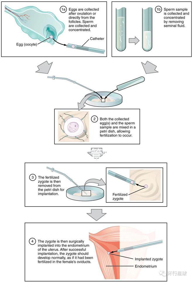 國內首起試管嬰兒案例，法律竟難以給患者維權