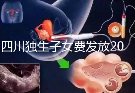 四川獨生子女費發(fā)放2024年新規(guī)定，如何盡快領(lǐng)取自貢？