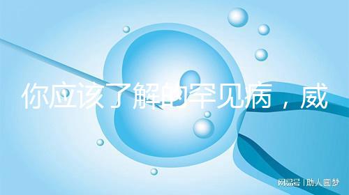 你應該了解的罕見病，威廉姆斯綜合癥