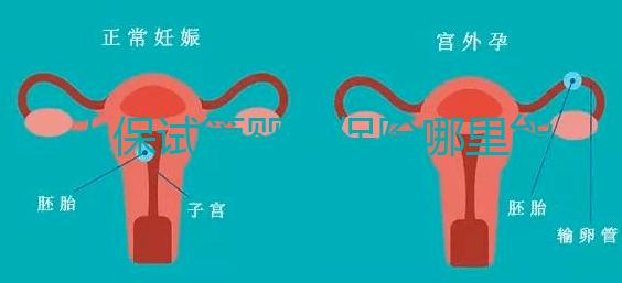 人保試管嬰兒保險哪里能買、怎么買速覽,一篇看懂不踩坑