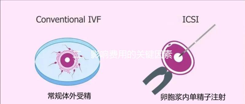 二、影響費(fèi)用的關(guān)鍵因素