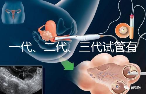 一代、二代、三代試管有什么區(qū)別？
