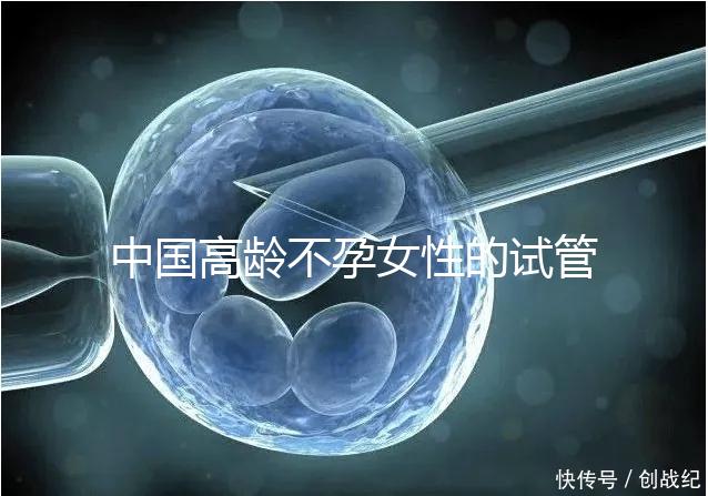 中國(guó)高齡不孕女性的試管嬰兒指南,8個(gè)方面5條推薦意見(jiàn)