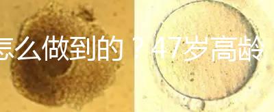 怎么做到的？47歲高齡試管嬰兒唯一男胚一次移植成功！