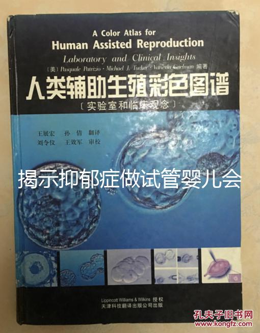 揭示抑郁癥做試管嬰兒會(huì)遺傳給女兒,想避免看這個(gè)