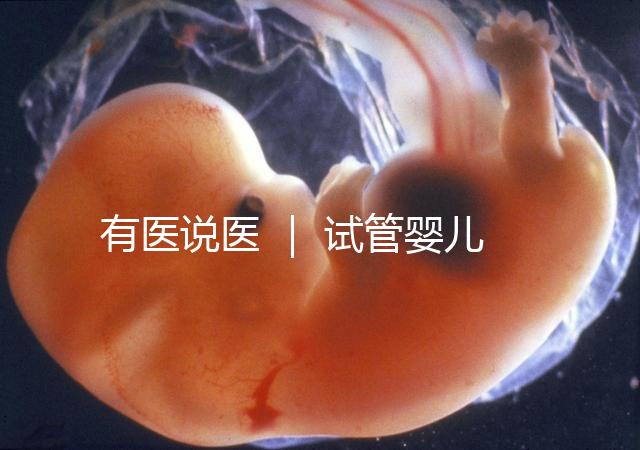 有醫(yī)說(shuō)醫(yī) ｜ 試管嬰兒技術(shù)不能避免宮外孕，“三孩”時(shí)代警惕宮外孕發(fā)生率增加