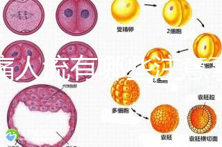 無痛人流有哪些注意事項？