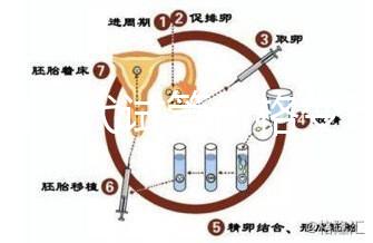 泰國(guó)三代試管價(jià)格變動(dòng)，2025年最新費(fèi)用行情一覽