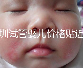 深圳試管嬰兒價格貼近百姓！三代試管只需8