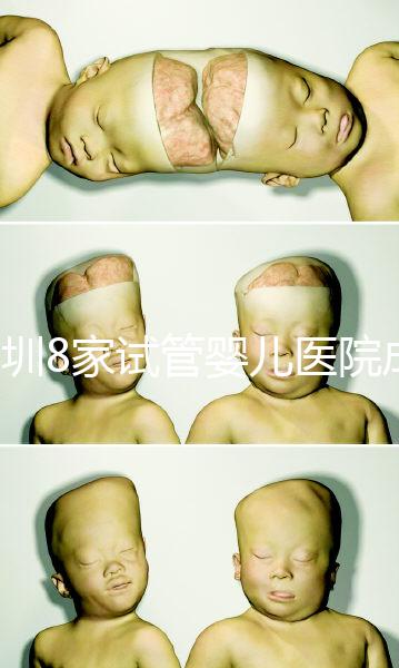 深圳8家試管嬰兒醫院成功率排名，供卵、供精首選各不同