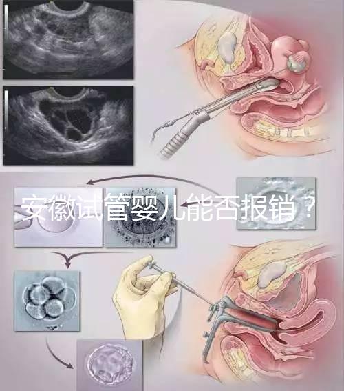 安徽試管嬰兒能否報銷？政策解讀幫您省錢！