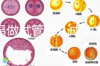 宜昌做試管嬰兒成功率和費(fèi)用多少？先看哪些醫(yī)院能做吧！