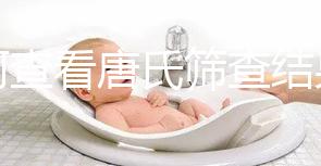 如何查看唐氏篩查結(jié)果,珠海醫(yī)院價格二百四起