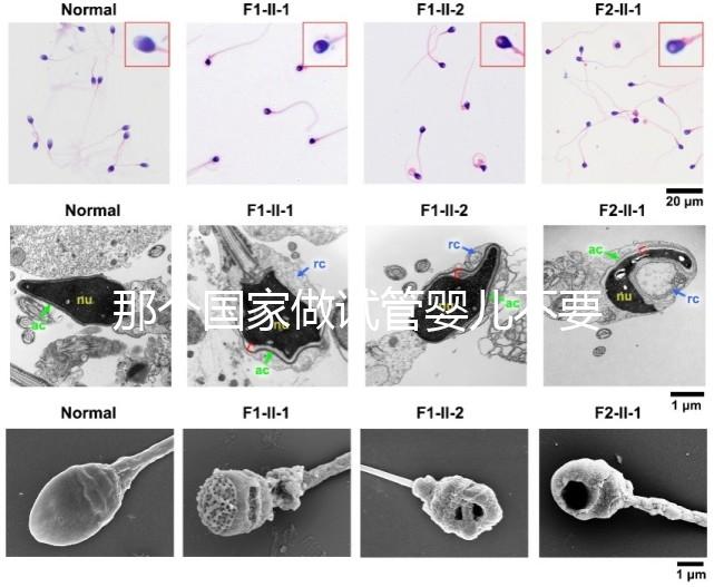 那個國家做試管嬰兒不要結(jié)婚證