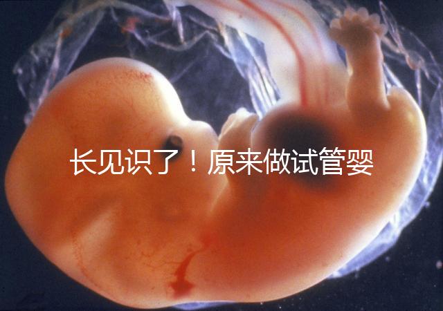 長(zhǎng)見(jiàn)識(shí)了!原來(lái)做試管嬰兒,精子是這樣被篩選出來(lái)的