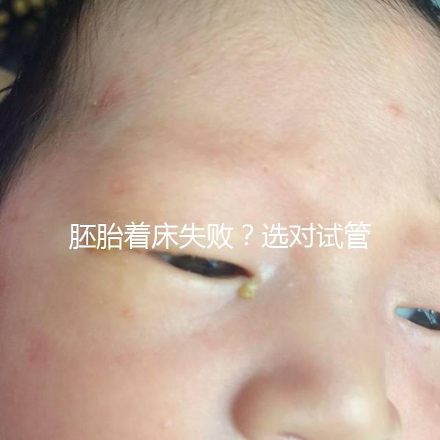 胚胎著床失敗?選對(duì)試管嬰兒醫(yī)生很重要