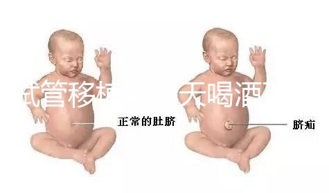 試管移植前幾天喝酒了有影響嗎？想要懷孕得管住嘴！