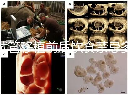 試管移植前后飲食禁忌多，十大不利于胚胎著床的水果別亂吃