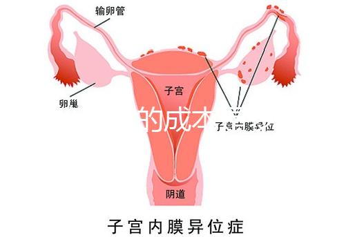 試管嬰兒的成本是多少？需要多少錢？