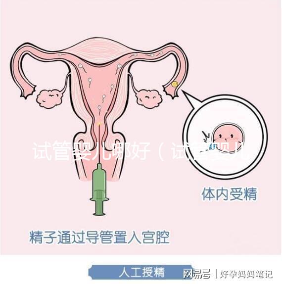 試管嬰兒哪好(試管嬰兒權威醫院哪家最好)