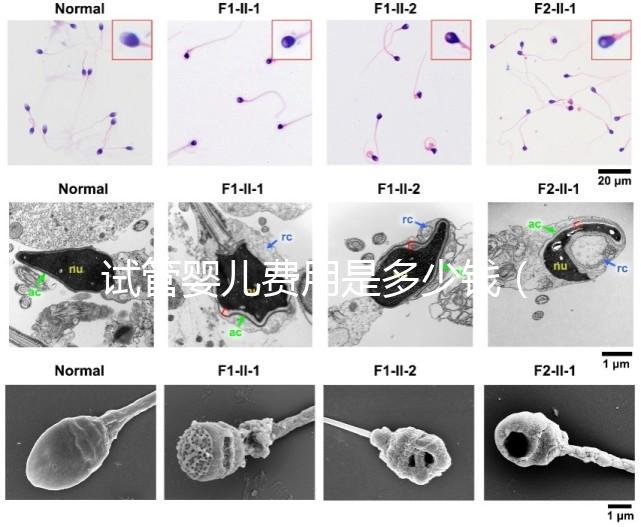 試管嬰兒費(fèi)用是多少錢(qián)(試管嬰兒費(fèi)用是多少錢(qián)一次)