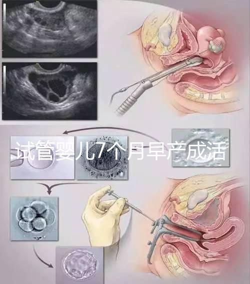 試管嬰兒7個(gè)月早產(chǎn)成活率高達(dá)80%！能不能要看身體狀況