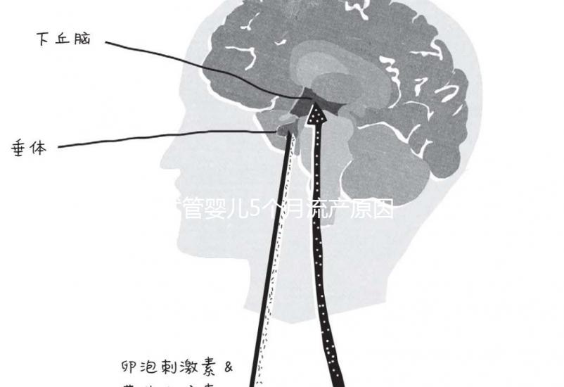 試管嬰兒5個(gè)月流產(chǎn)原因有三,多久能再次移植需慎重考慮