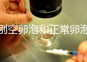 辨別空卵泡和正常卵泡是有技巧的，只需要了解這四個方面就可以輕松辨別，快速學(xué)習(xí)！