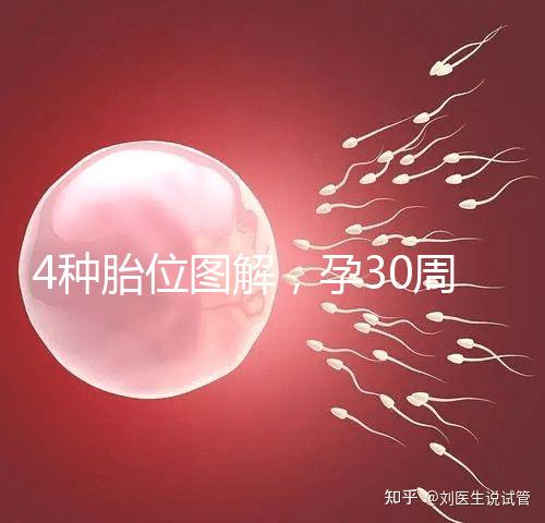 4種胎位圖解,孕30周這個姿勢最適合順產