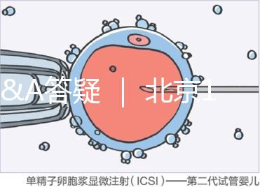 Q&A答疑 ｜ 北京16項輔助生殖技術進醫保，試管可以報銷嗎？