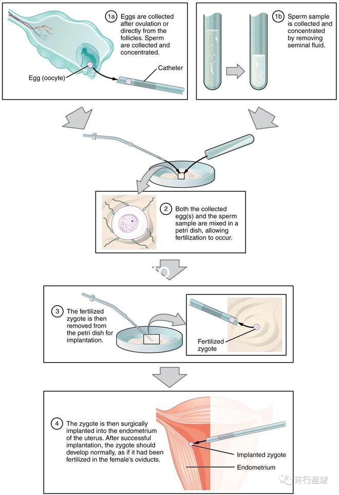 Reprod. Biomed:奇跡、突破、爭(zhēng)議、反思——“試管嬰兒”40年